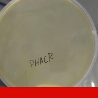 Universidade do Minho planeia laboratório para produzir vírus que matam bactérias
