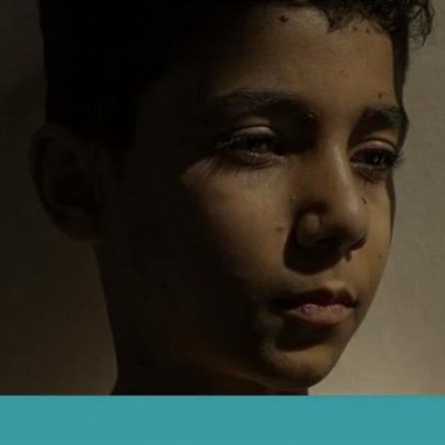 Terça traz World Press Photo e prato Couves com Feijões