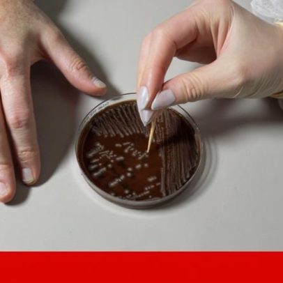 Resistência antimicrobiana causa cerca de 35 mil mortes anuais na UE