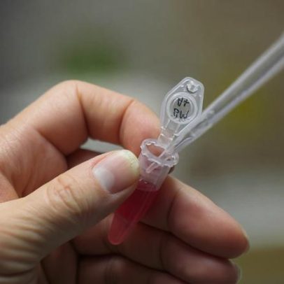 Mais de seis milhões de euros para nove investigações biomédicas portuguesas
