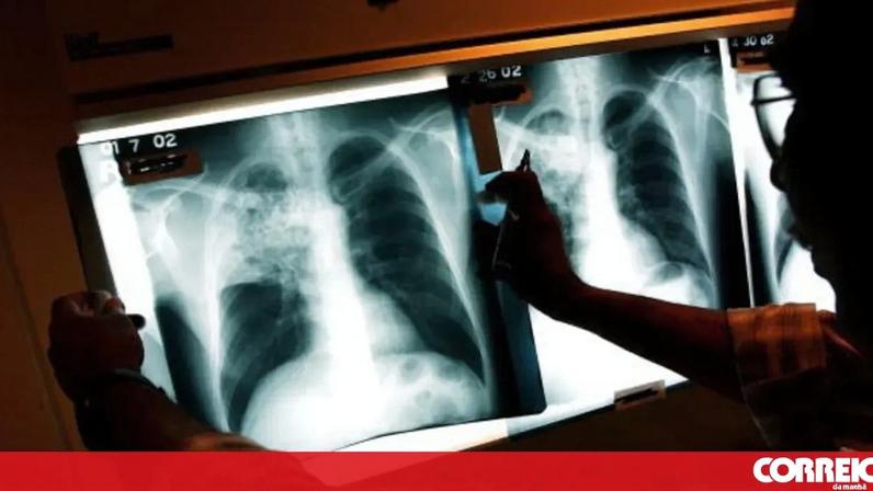 Tuberculose - FOTO: Getty Images