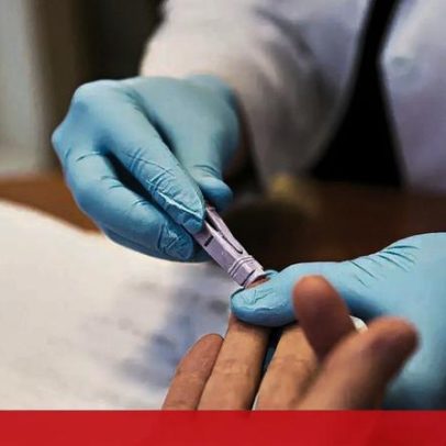 Portugal regista 108 óbitos por VIH em 2024
