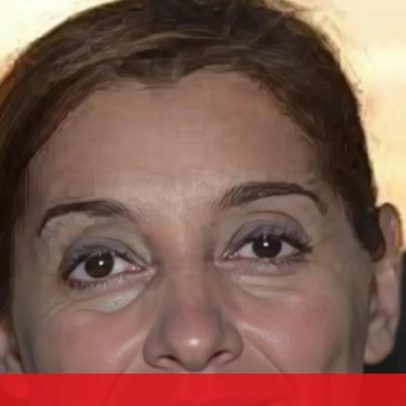 Campeã do Ozempic burla o Estado em 3 milhões durante 11 anos