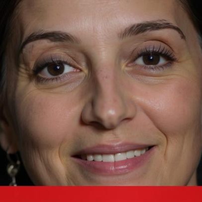 Campeã do Ozempic burlou o Estado em três milhões ao longo de 11 anos