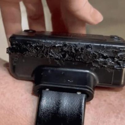 Bolsonaro afirma ter tentado abrir pulseira eletrónica por curiosidade