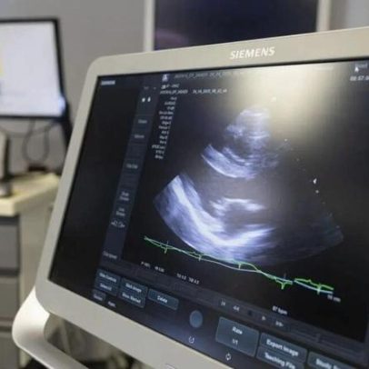 Regulador de saúde alerta sobre ecografias emocionais e vouchers de Natal
