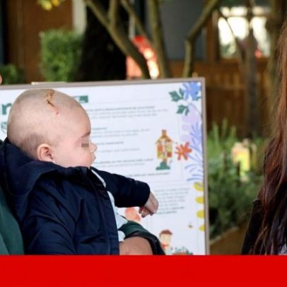Bebé com 60 crises de epilepsia é operado no Santa Maria e fica sem crises