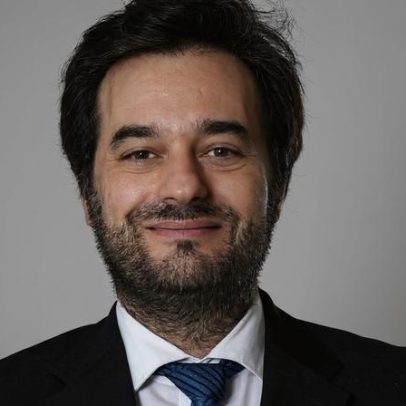 Alopecia areata, doença autoimune que altera a relação com o espelho