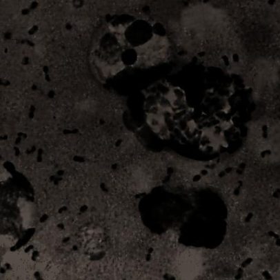 Erupção vulcânica pode ter acelerado propagação da Peste Negra, aponta estudo