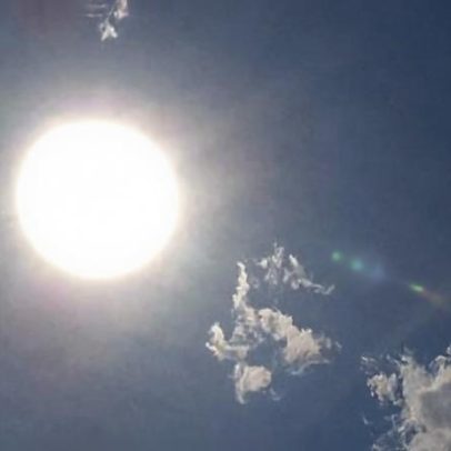 Proteção solar no inverno: é necessária?