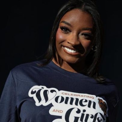 Simone Biles revela intervenções estéticas como expressão de amor-próprio