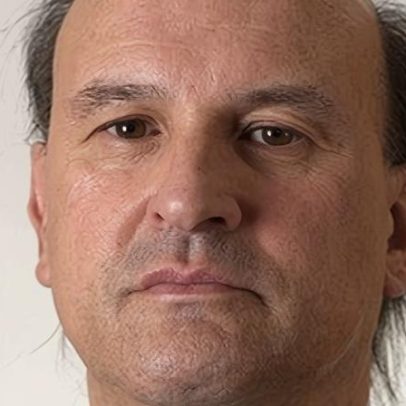 Pressão sobre o SNS: esperas, custos e recursos sob análise