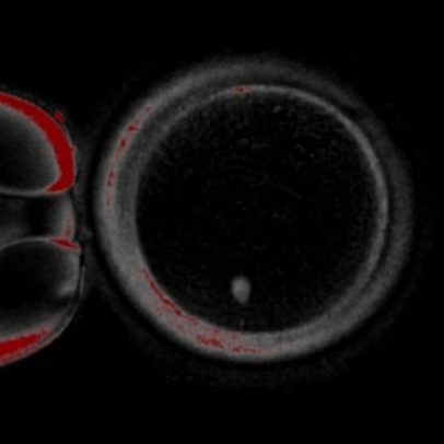 Natal registra 12 mortes nas estradas