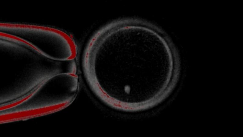Motociclista de 21 anos morreu após uma colisão contra um carro, no Marco de Canaveses