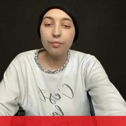 Porto confirma que nenhuma abordagem médica foi eficaz no tratamento de jovem de 23