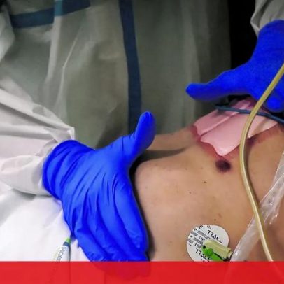 Excesso de mortalidade em semana de gripe: 121 mortes acima do habitual