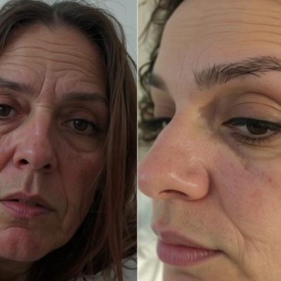 Mulher brasileira é espancada e esfaqueada no Porto; marido fugiu para o Brasil