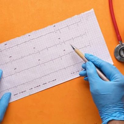Beja hospital realiza 1º implante de marcapasso sem eletrodo