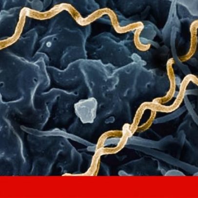 Genoma de bactéria da sífilis de 5,5 mil anos traz novas pistas sobre origens