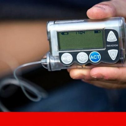 Mais de 2.800 bombas de insulina entregues a diabéticos tipo 1