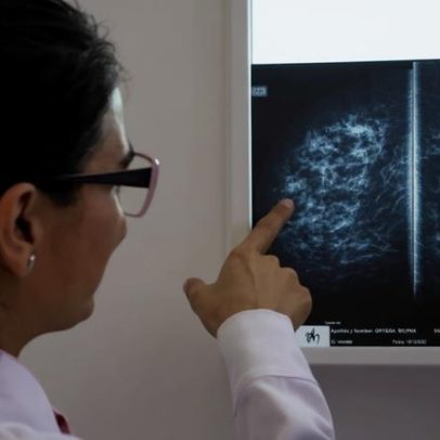 SNS deve assegurar acesso atempado a exames médicos, afirma ERS