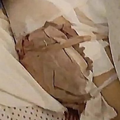 Lar ilegal em Sintra investigado por maus-tratos a idosos