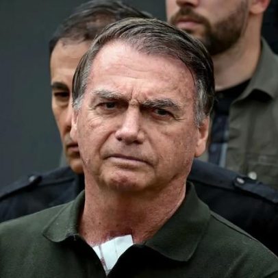 Bolsonaro hospitalizado após queda na cela com golpe na cabeça