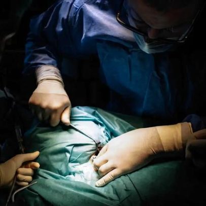 Médicos russos removem tumor de mais de 60 quilos de paciente