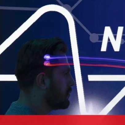 Elon Musk pretende implantar chips em humanos
