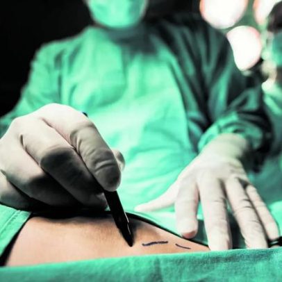 Médicos russos removem tumor de gordura de mais de 60 quilos