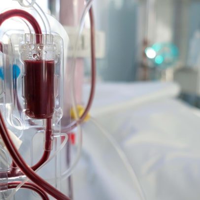 Doses personalizadas de hemodiálise elevam sobrevivência dos pacientes