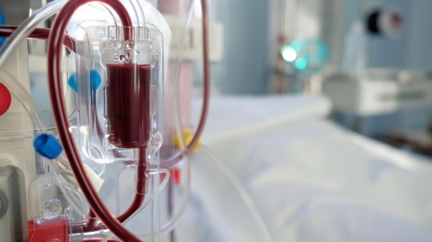 Doses personalizadas de hemodiálise elevam sobrevivência dos pacientes