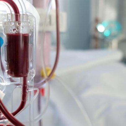 Doses personalizadas de diálise aumentam sobrevivência de pacientes
