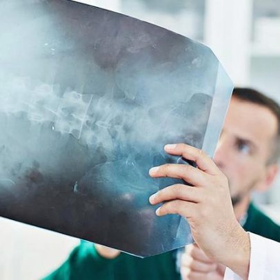 ULS Viseu Dão-Lafões mantém ativo o Serviço de Apoio Complementar