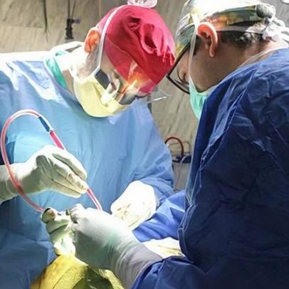 ULS da Cova da Beira faz primeira cirurgia inovadora para tumor cerebral