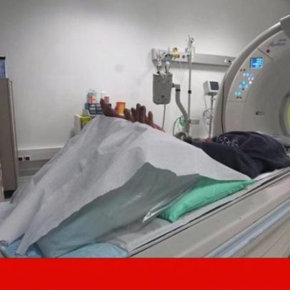 Rastreio do Cancro do Pulmão: pacote de saúde oferecido aos utentes