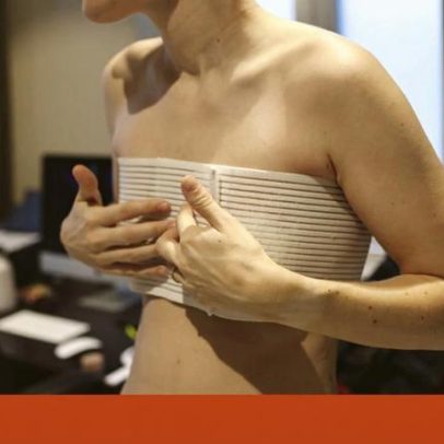 Associações médicas dos EUA contra cirurgias de redesignação antes de 19 anos