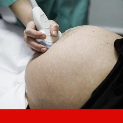 Autonomia de enfermeiros na vigilância de grávidas chega tarde