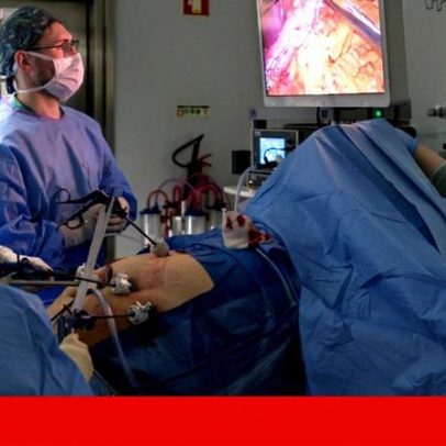 Mais de 19 mil pessoas fizeram cirurgia de obesidade nos últimos cinco anos