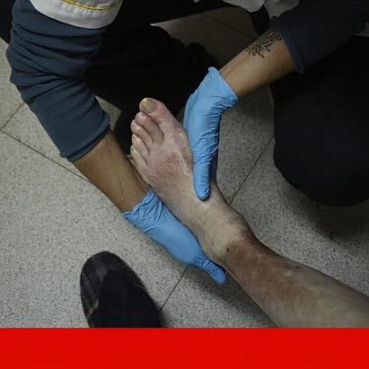 Despesa do SNS com Medicina Física e Reabilitação sobe quase 60% em três anos