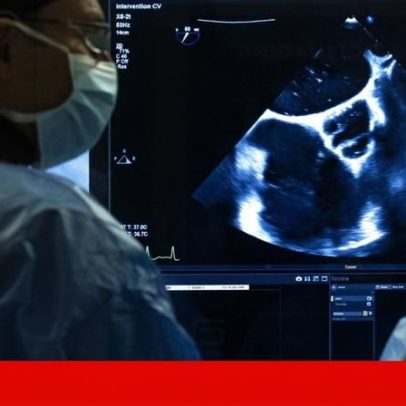 Governo apoia centro de cirurgia cardíaca no norte; médicos preocupados