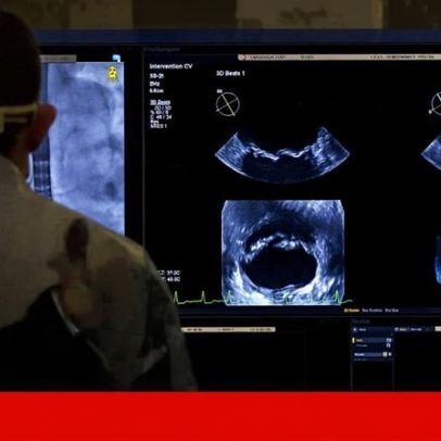 Mortes à espera de cirurgia cardíaca: Governo ordena apuramento rigoroso