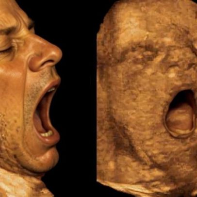 Bocejos de fetos saudáveis no útero ligados a menor peso ao nascer