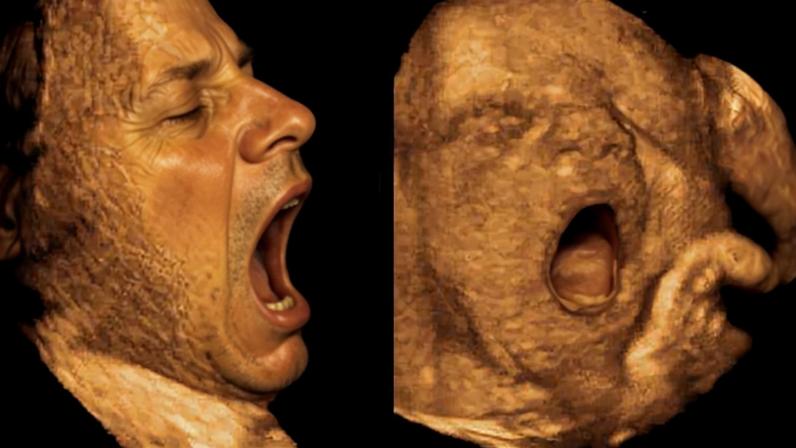 Um bocejo fetal às 23 semanas de gestação
