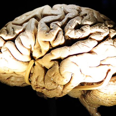 APCCerebro comemora aniversário e reforça missão de dar voz ao silêncio