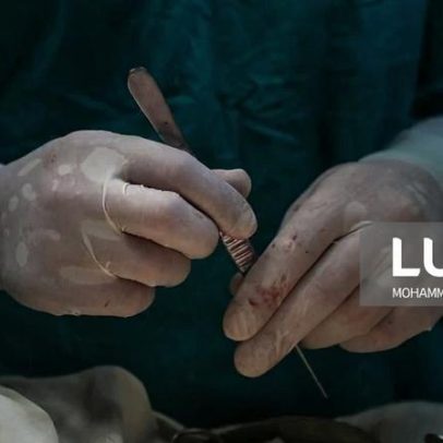 Reguladora de Saúde investiga barreiras de acesso à cirurgia cardíaca