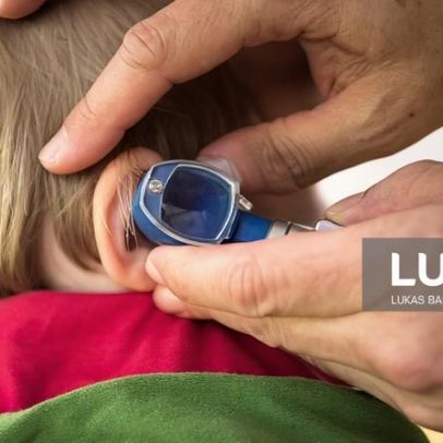 Sarampo em países europeus e Portugal com 21 casos em 2025, diz relatório