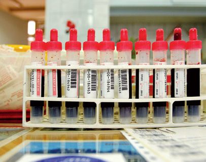 Associação de Dadores de Sangue promove colheita numa empresa de Landim