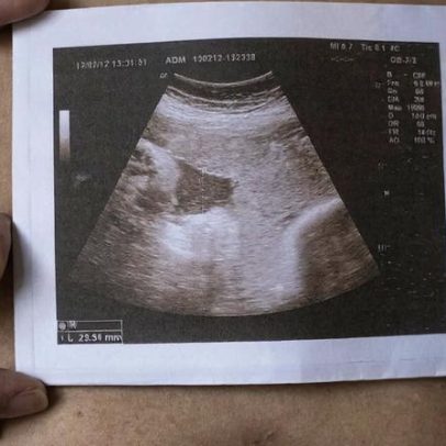 UE admite uso de verbas para aborto acessível, diz Bruxelas
