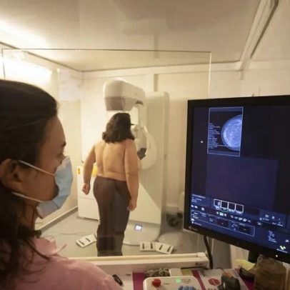 Um em cada quatro doentes oncológicos operados após o tempo máximo de espera